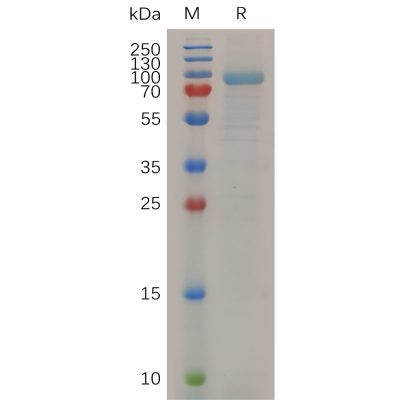 sp-pme m100030 mmp13 sp1