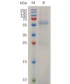 sp-pme m100031 mmp13 sp1