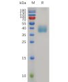 sp-pme m100040 mesothelin sp1