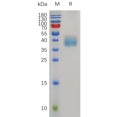 sp-pme m100040 mesothelin sp1