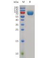 sp-pme m100041 dnam 1 sp1