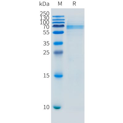 sp-pme m100113 fcrl5 sp1