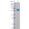 sp-pme100011 4 1bb sp1