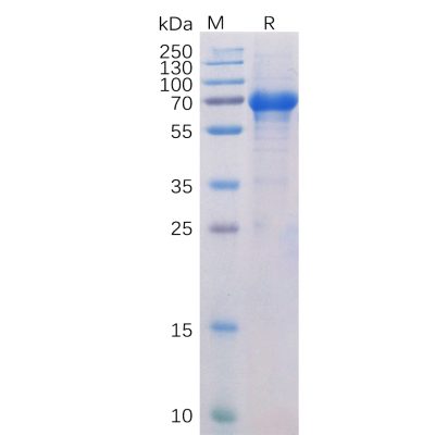 sp-pme100022 ox40 sp1