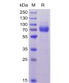 sp-pme100039 cd33 sp1