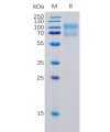 sp-pme100047 b7 1 sp1