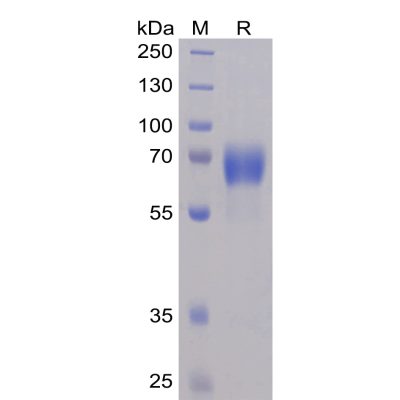 sp-pme100059 ntba sp1