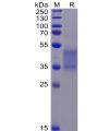 sp-pme100069 fcgr3a sp1