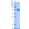 sp-pme100081 nkp30 sp1
