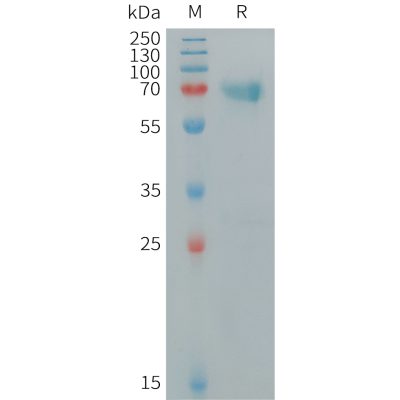 sp-pme100082 tnfrsf1b sp1