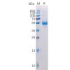 sp-pme100100 tnfsf11 sp1