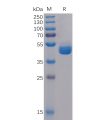 sp-pme100107 tigit sp1