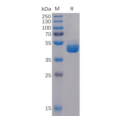 sp-pme100107 tigit sp1