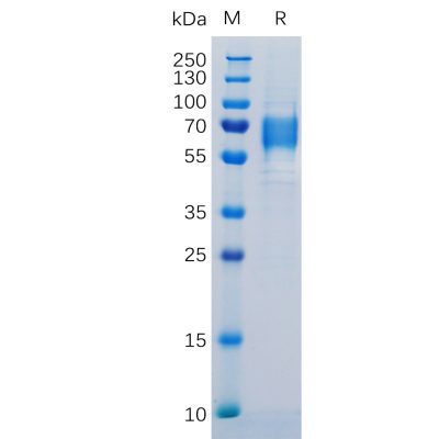 sp-pme100109 il6r sp1