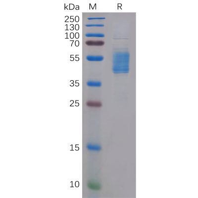 sp-pme100112 ccr4 sp1