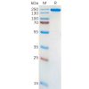 sp-pme100134 alk sp1