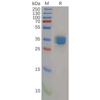 sp-pme100156 cb2 sp1