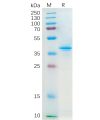 sp-pme100159 ccl20 sp1