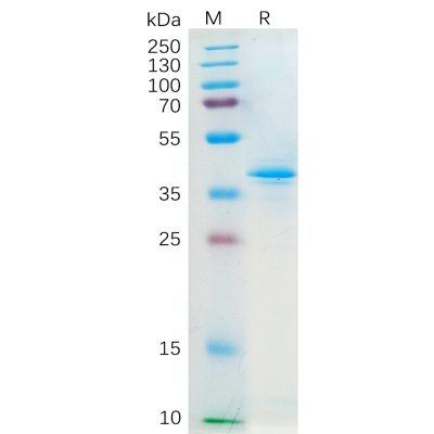 sp-pme100159 ccl20 sp1