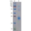 sp-pme100208 clec2d sp1