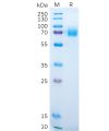 sp-pme100230 dkk1 sp1