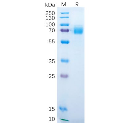 sp-pme100230 dkk1 sp1