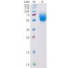 sp-pme100291 il13ra1 sp1