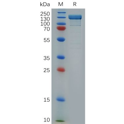 sp-pme100311 itgb1 sp1