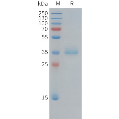 sp-pme100315 ki67 sp1