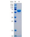 sp-pme100402 siglec15 sp1