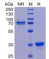 sp-pme100463 tweakr sp1