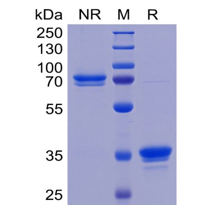 sp-pme100463 tweakr sp1