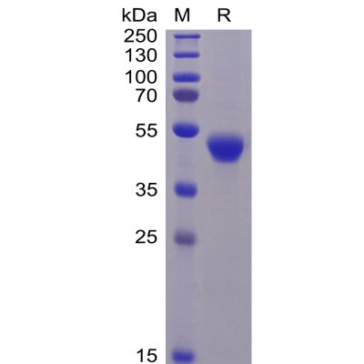 sp-pme100470 cd5 sp1