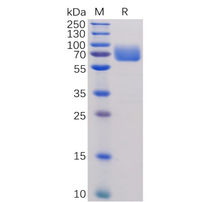 sp-pme100473 b7 1 sp1