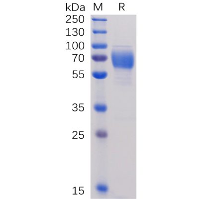 sp-pme100477 2b4 sp1