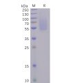 sp-pme100491 s1 protein ntd sp1