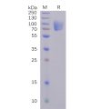 sp-pme100492 s1 protein ntd sp1