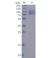 sp-pme100493 s1 protein ntd sp1