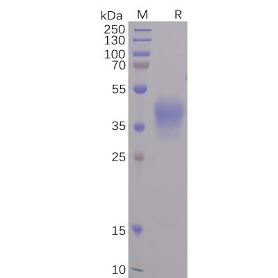 sp-pme100498 rbd m sp1