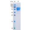 sp-pme100507 cb1 sp1
