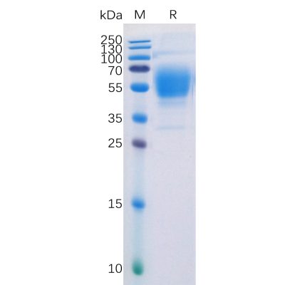 sp-pme100507 cb1 sp1