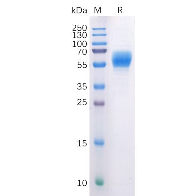 sp-pme100508 cb1 sp1