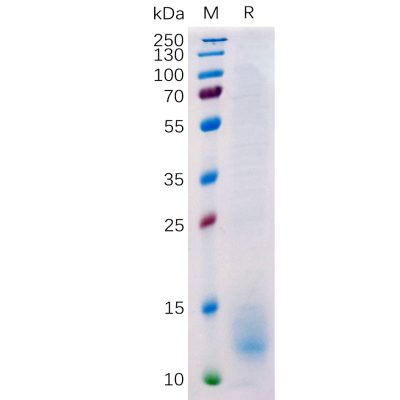 sp-pme100511 bcma sp1