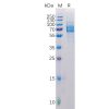 sp-pme100515 galectin 9 sp1