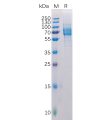 sp-pme100515 galectin 9 sp1