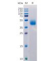 sp-pme100516 micb sp1