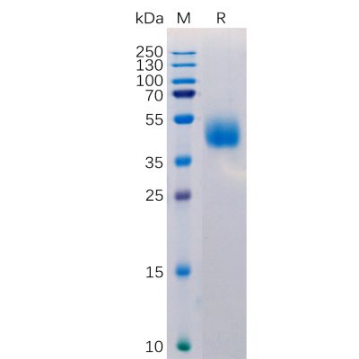 sp-pme100516 micb sp1