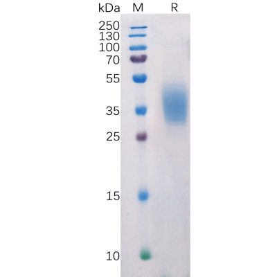 sp-pme100518 pdl2 sp1