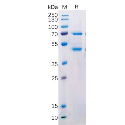 sp-pme100520 masp2 sp1