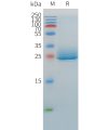 sp-pme100527 angptl3 sp1